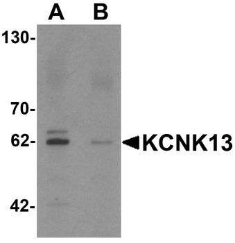 KCNK13 Antibody