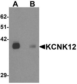 KCNK12 Antibody