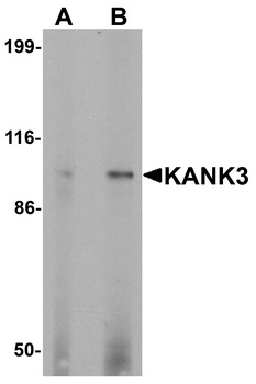 KANK3 Antibody