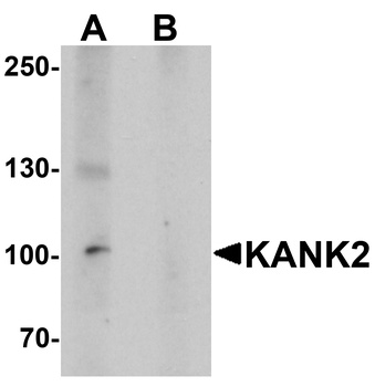 KANK2 Antibody