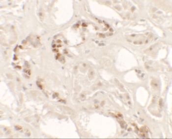 KANK2 Antibody