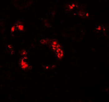 KANK2 Antibody