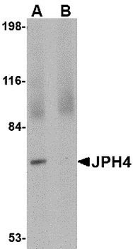 JPH4 Antibody