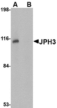 JPH3 Antibody