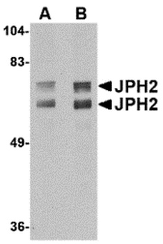 JPH4 Antibody