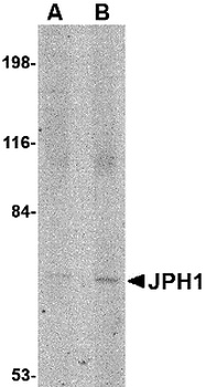 JPH1 Antibody