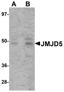 KDM8 Antibody