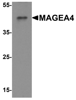 MAGEA4 Antibody