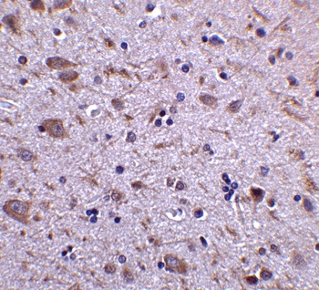 IRGM Antibody