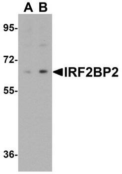 IRF2BP2 Antibody