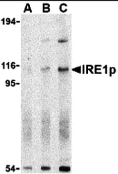 IRE1p Antibody
