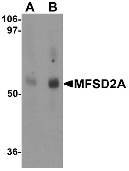MFSD2A Antibody