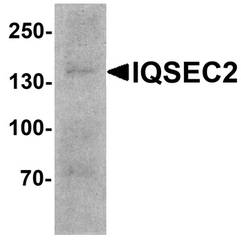 IQSEC2 Antibody