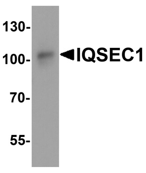 IQSEC1 Antibody