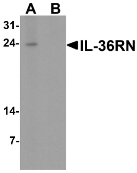 IL36RN Antibody
