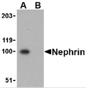 NPHS1 Antibody