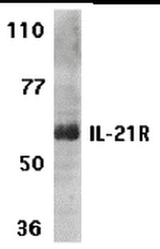 IL21R Antibody