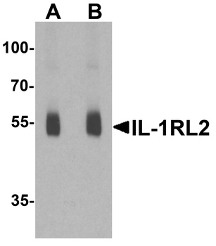 IL1RL2 Antibody