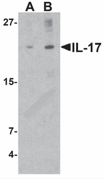 IL17A Antibody