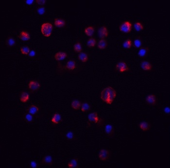 IL-11 Antibody