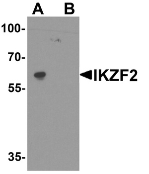 IKZF2 Antibody
