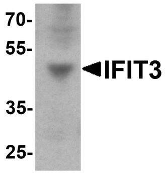 IFIT3 Antibody