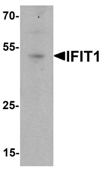 IFIT1 Antibody