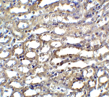 Dffa Antibody