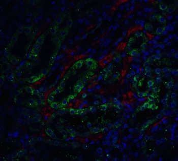 Dffa Antibody