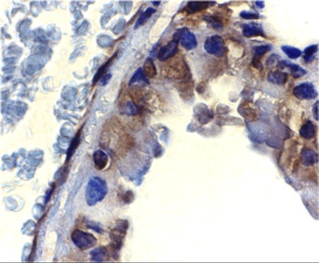 Dffa Antibody