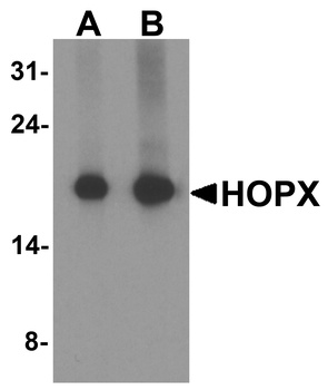 HOPX Antibody
