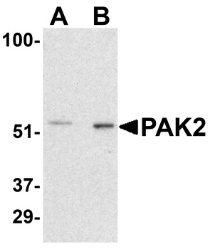 PAK2 Antibody