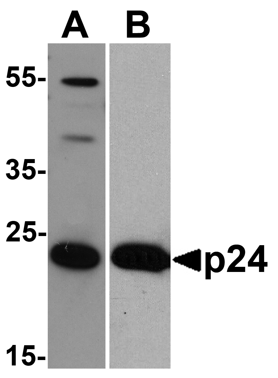 HIV-1 p24 Antibody [8G9]