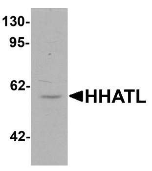 HHATL Antibody