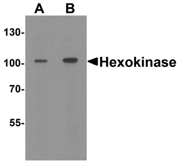 HK1 Antibody