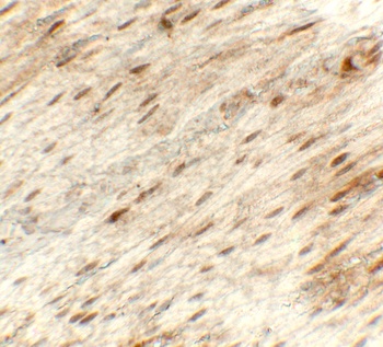 HK1 Antibody