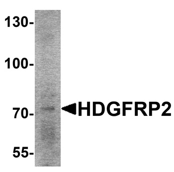 HDGFRP2 Antibody