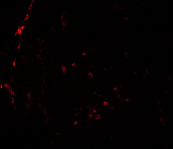 HDAC2 Antibody
