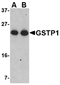 GSTP1 Antibody