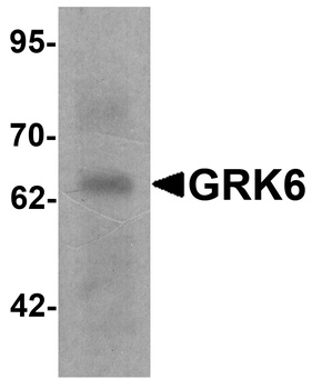 GRK6 Antibody
