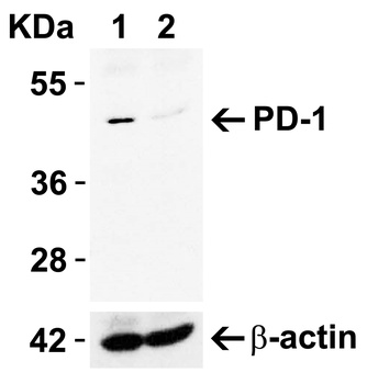 PDCD1 Antibody