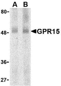 GPR15 Antibody