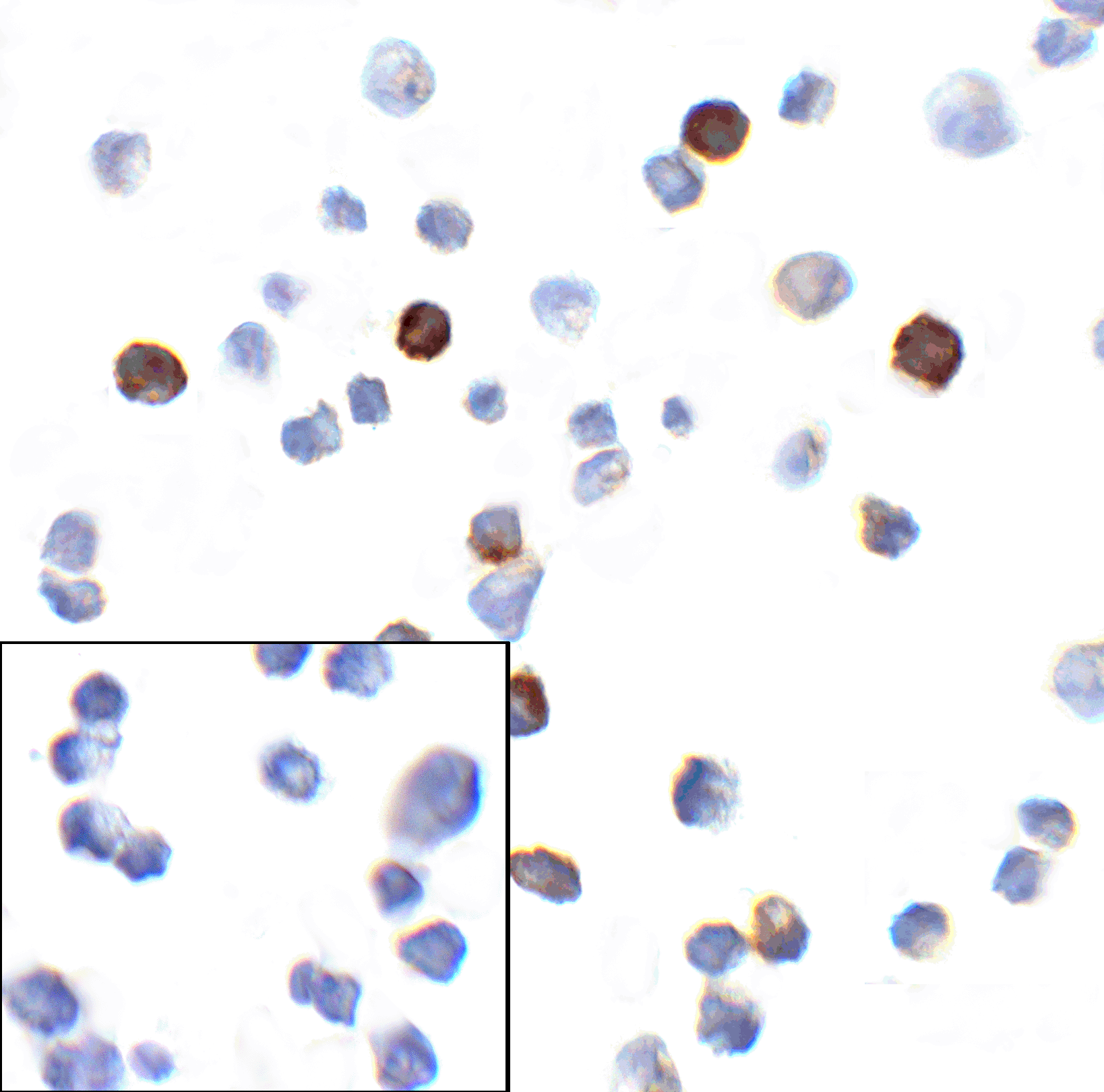 PDCD1 Antibody