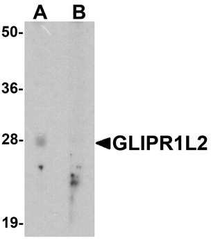 GLIPR1L2 Antibody