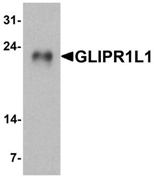 GLIPR1L1 Antibody
