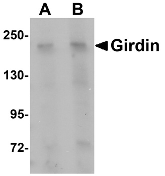 CCDC88A Antibody