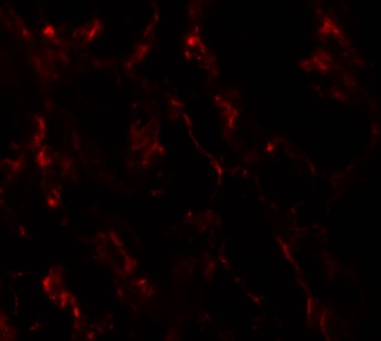 GHDC Antibody