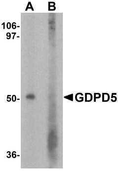 GDPD5 Antibody