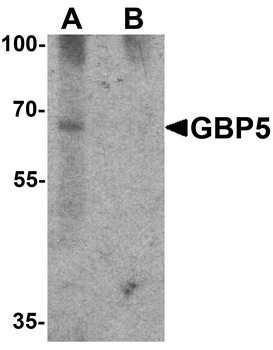 GBP5 Antibody