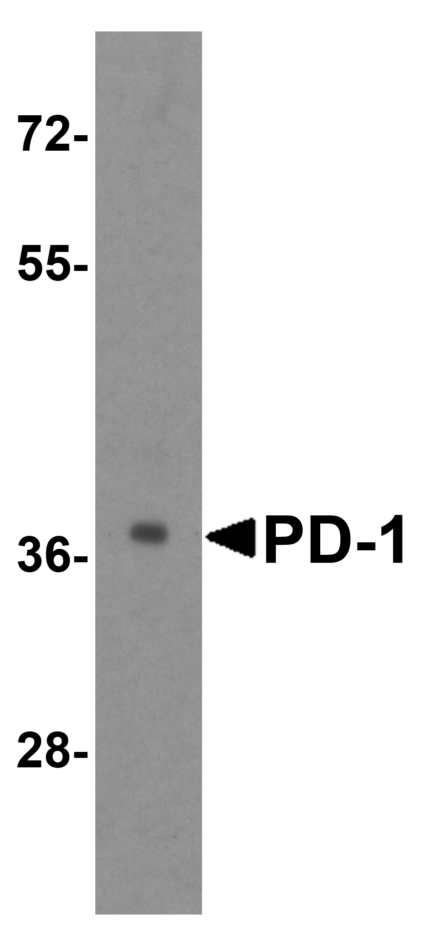 PDCD1 Antibody